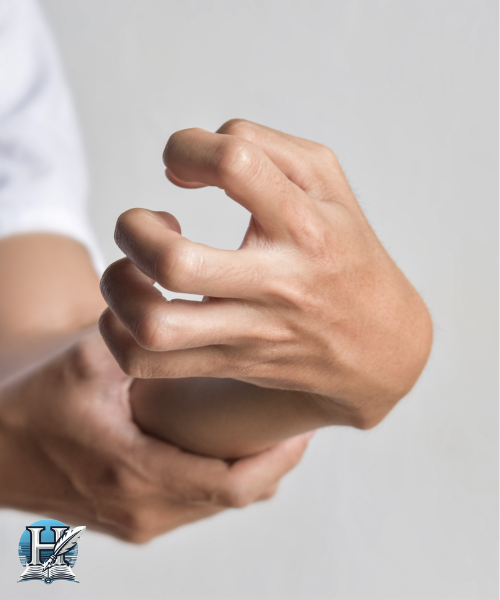 تيبّس العضلات (Rigidity)