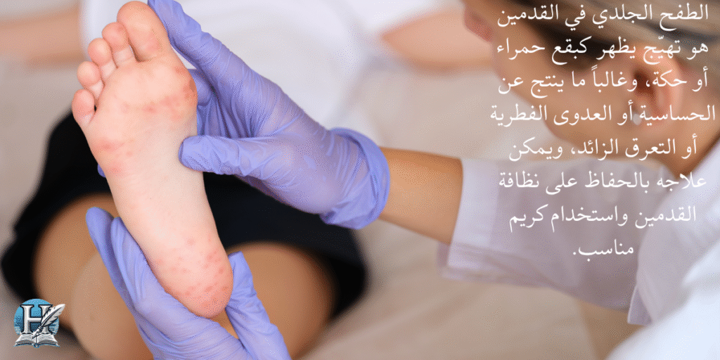 الطفح الجلدي بالقدمين