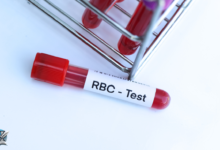 ما هو تحليل rbc
