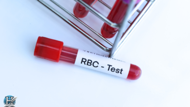 ما هو تحليل rbc